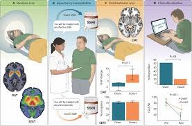 The Paradoxical Effects of Antidepressants: When Treatment Challenges Expectations